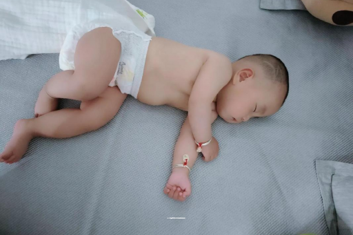 晋中宝宝头上长痱子